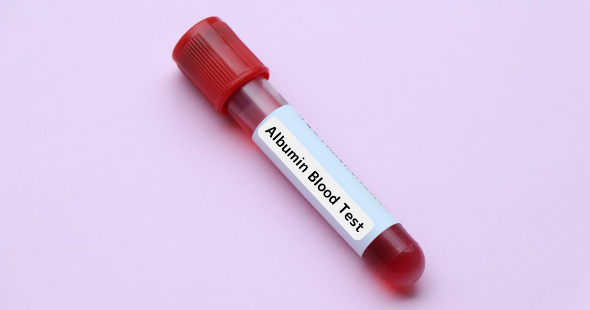 アルブミン血液検査